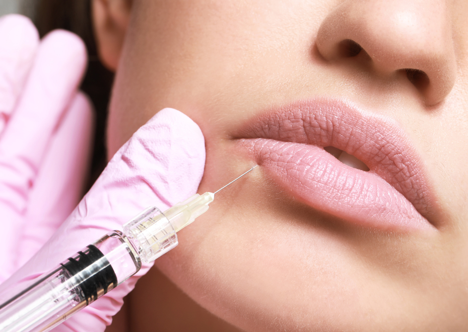 9 - RiKo Aesthetics A lady being injected with dermal filler in her lower lip