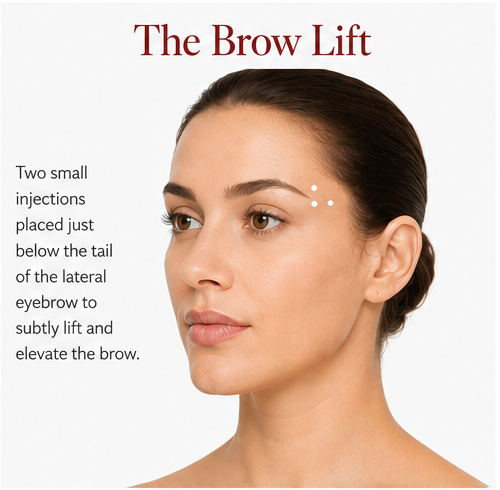 Anti-Wrinkle Injections in Hemel Hempstead: The Complete Guide 5 The Brow Lift