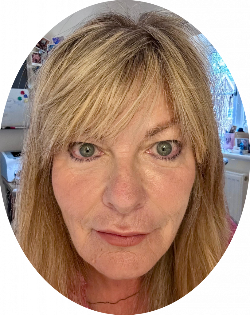 Client selfie after anti-wrinkle and dermal filler treatments